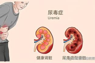 76人马克西托哈恩比德三人单场同砍30+ 队史62年来首次